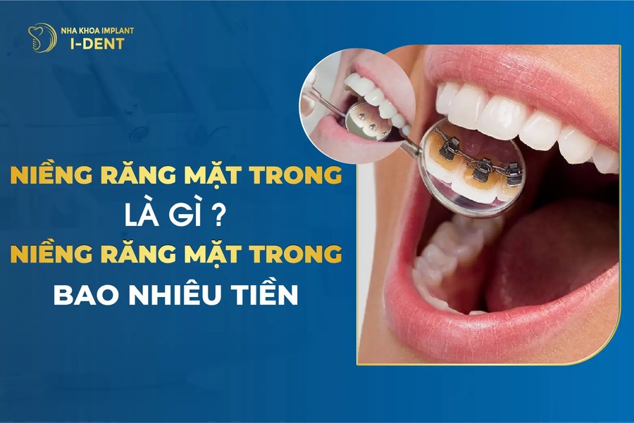 Nieng Rang Mat Trong