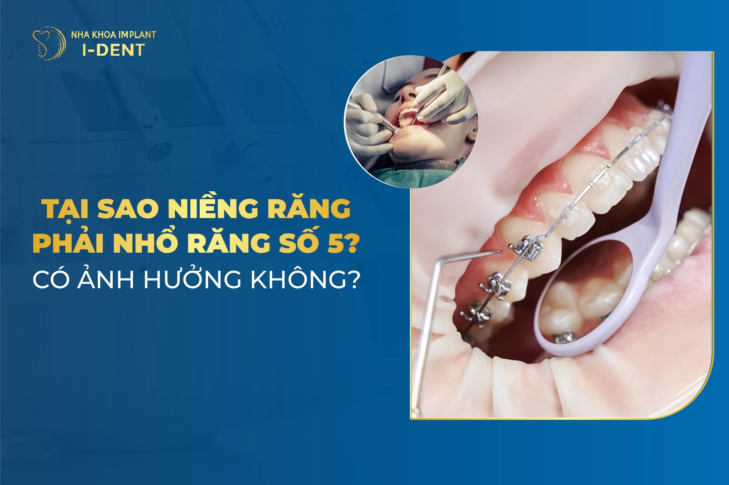 Nieng Rang Nho Rang So 5