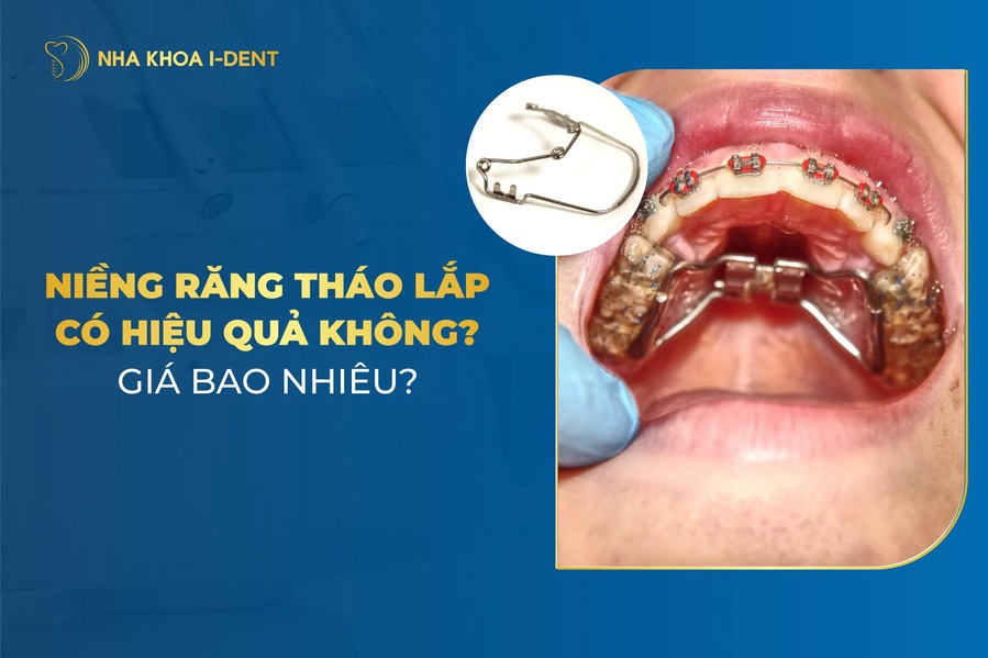 Nieng Rang Thao Lap 1