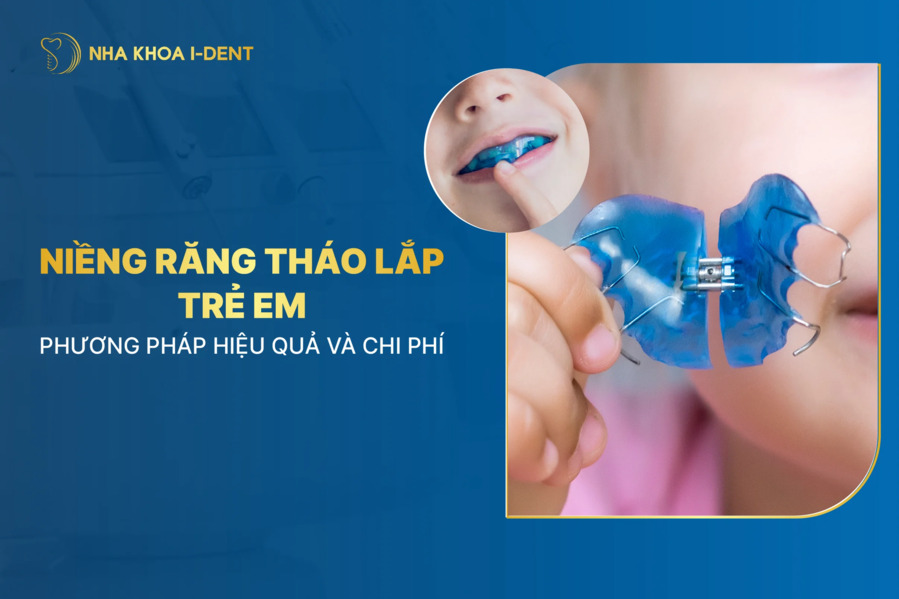 Niềng Răng Tháo Lắp Trẻ Em