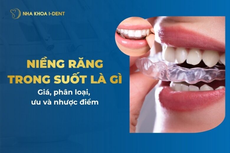 Niềng Răng Trong Suốt Là Gì? Chí Phí, Phân Loại, Ưu Và Nhược Điểm