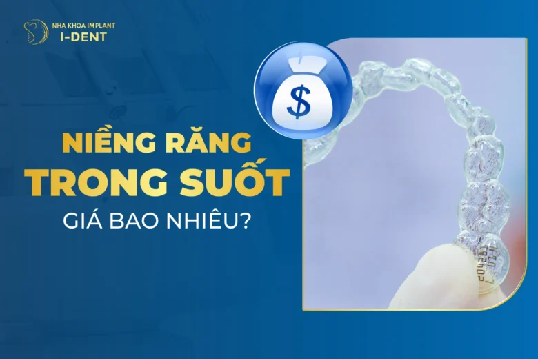 [T3/2026] Niềng Răng Trong Suốt Giá Bao Nhiêu? Giá Niềng Chi Tiết