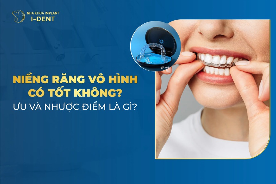 Nieng Rang Vo Hinh