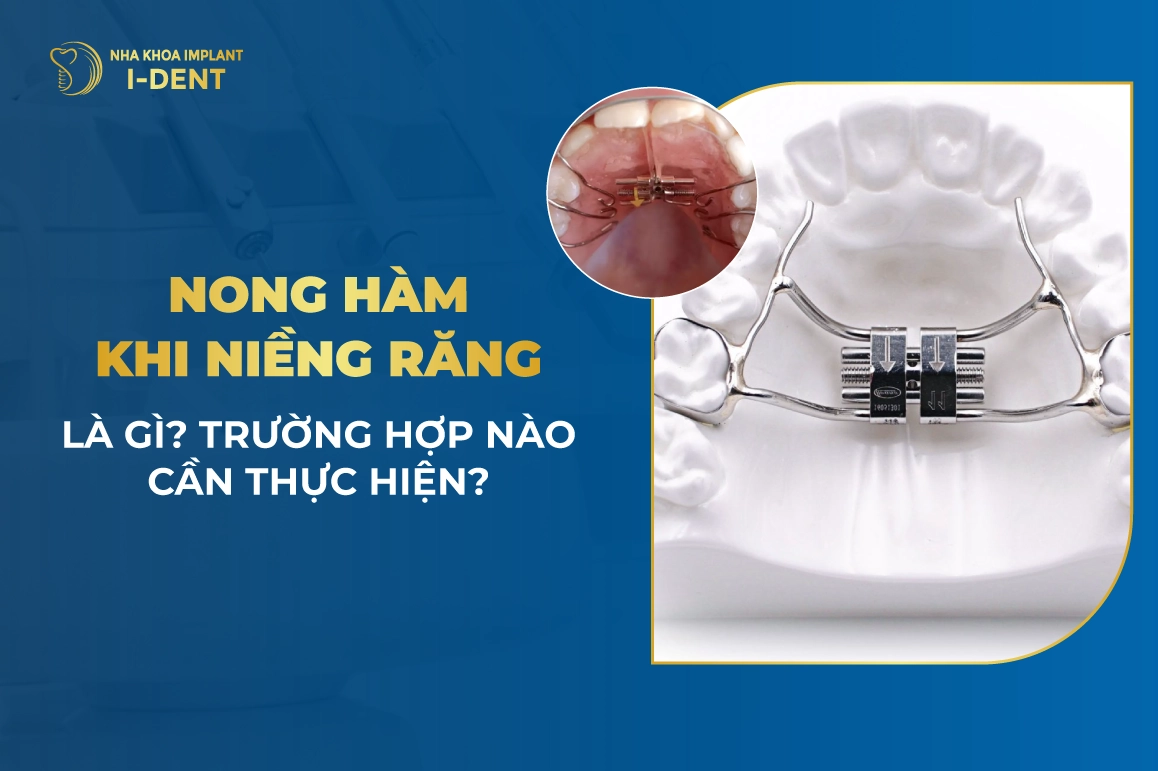 Nong Ham Khi Nieng Rang La Gi Nhung Truong Hop Nao Can Thuc Hien