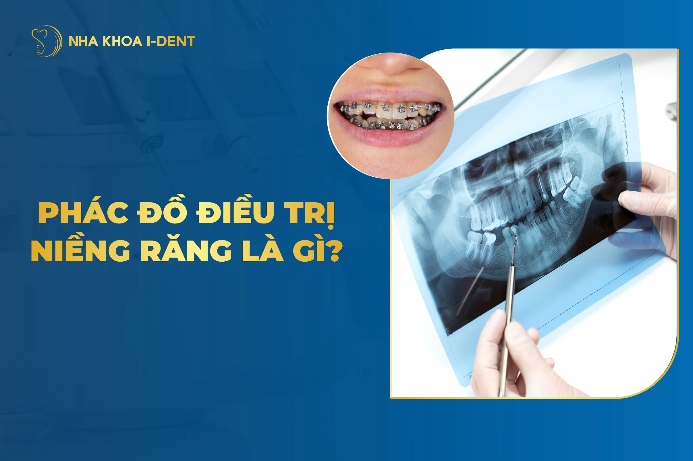 Phac Do Dieu Tri Nieng Rang