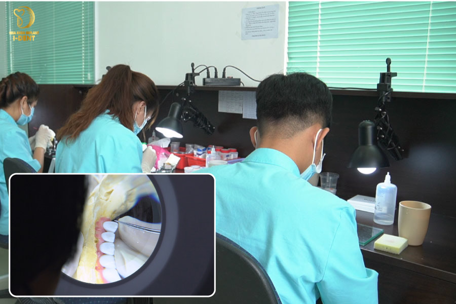 lắp răng sứ