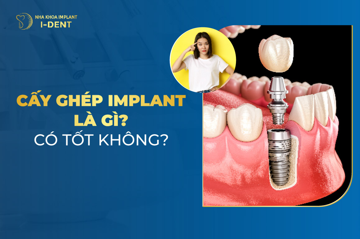 – Nha Khoa I Dent