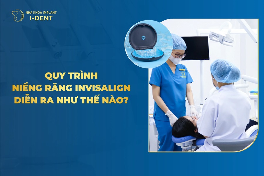 Quy Trinh Nieng Rang Invisalign