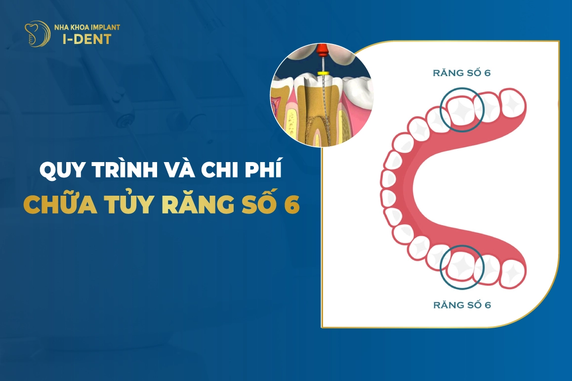 Quy Trinh Va Chi Phi Chua Tuy Rang So 6