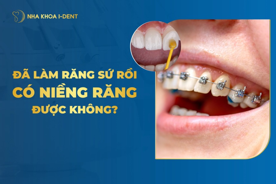 Rang Boc Su Co Nieng Rang Duoc Khong
