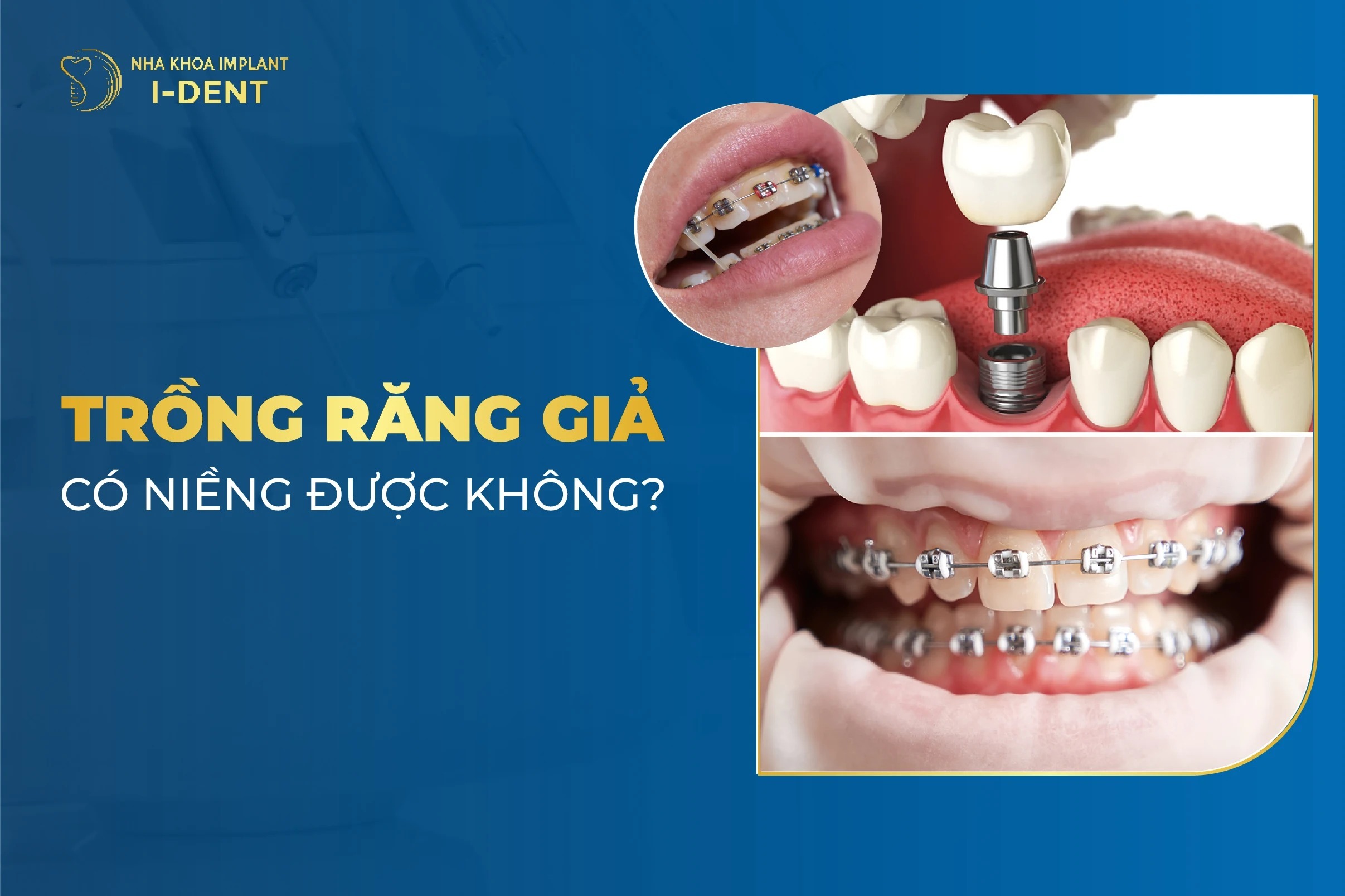 Rang Gia Co Nieng Duoc Khong