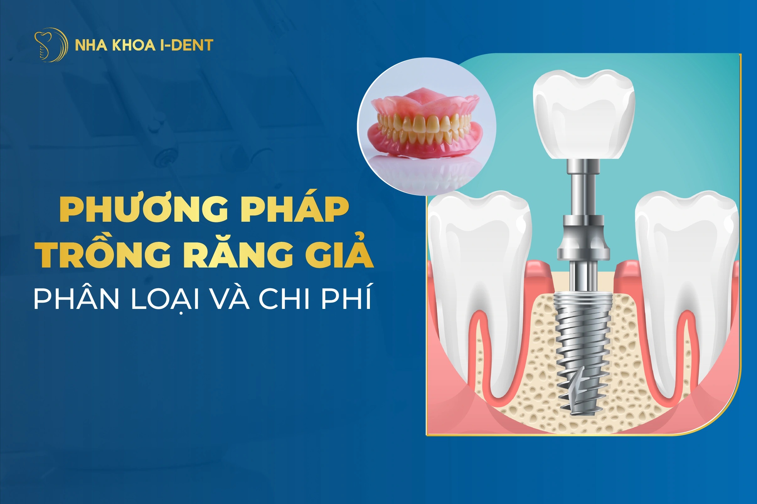 Răng Giả