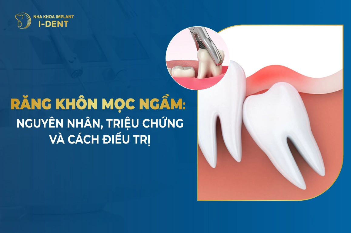 Rang Khon Moc Ngam