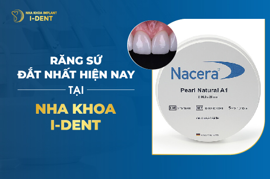 Răng Sứ Đắt Nhất Hiện Nay Tại Nha Khoa I Dent