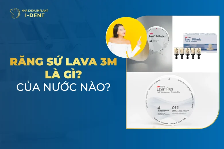 Răng Sứ Lava 3M Là Gì? Có Mấy Loại? Có Tốt Không?