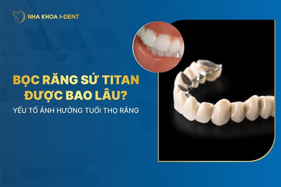 Rang Su Titan Su Dung Duoc Bao Lau