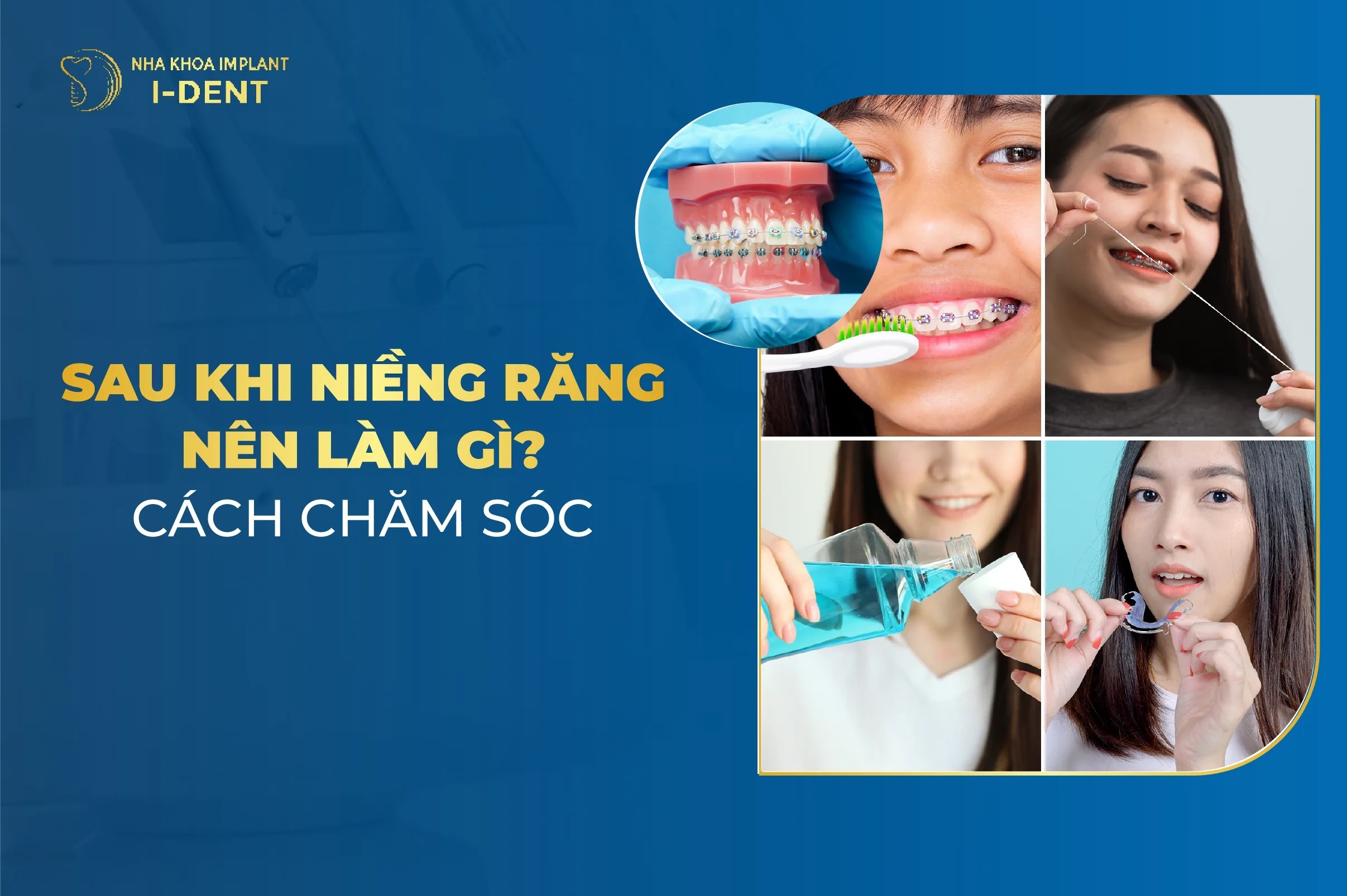 Sau Khi Thao Nieng Rang Can Lam Gi