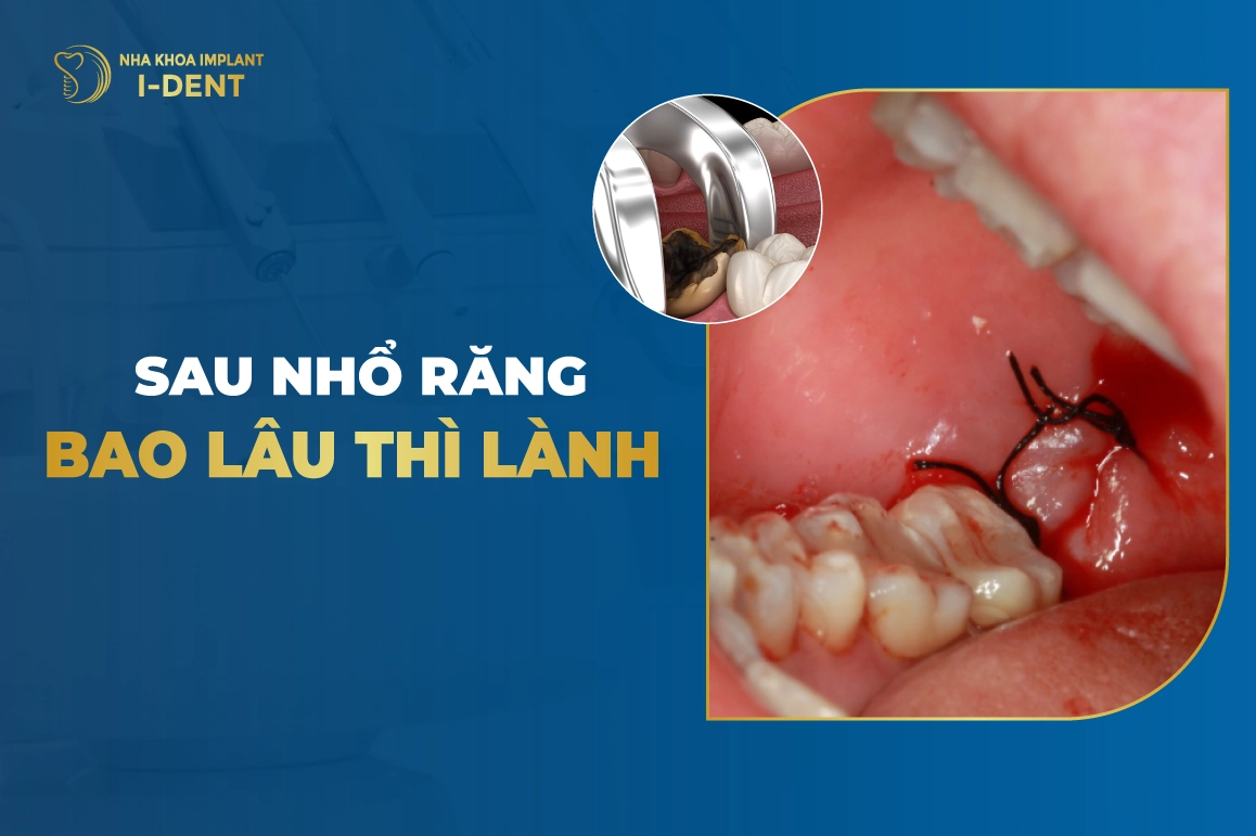 Sau Nho Rang Bao Lau Thi Lanh