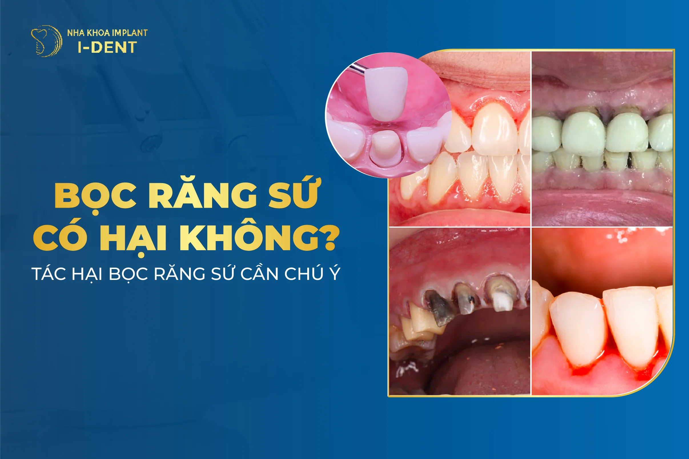 Tac Hai Cua Boc Rang Su