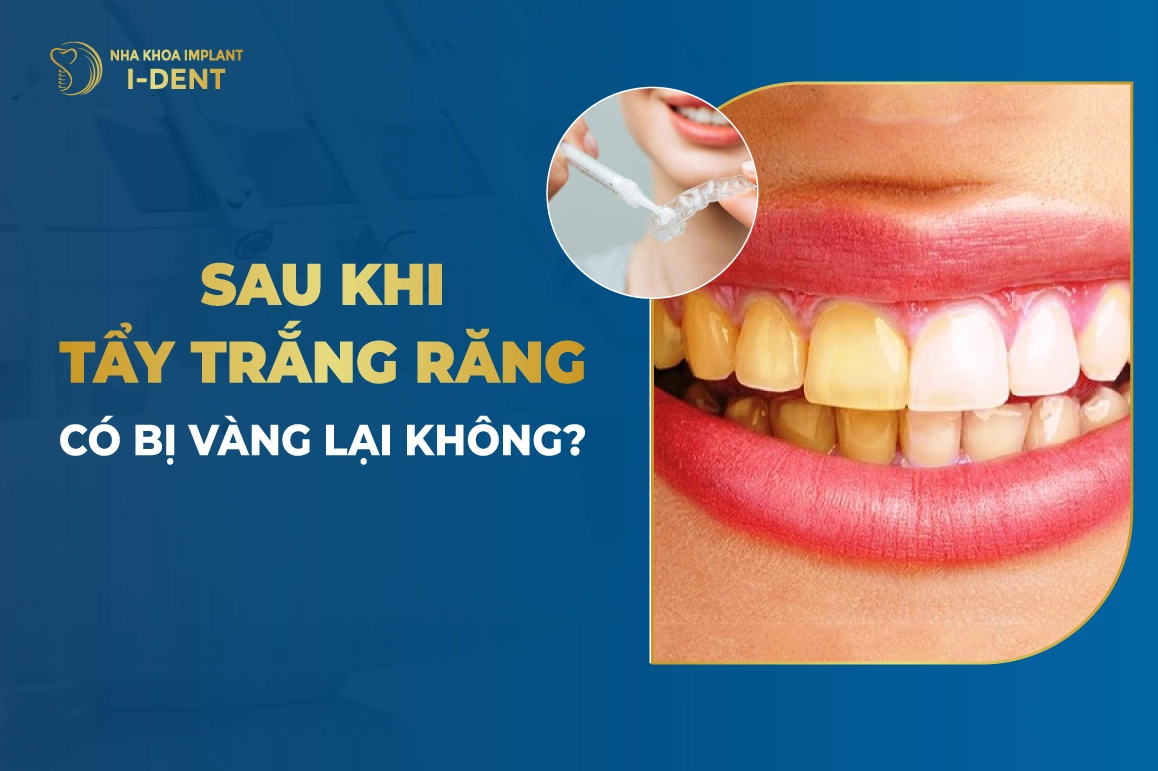 Tay Trang Rang Co Bi Vang Lai Khong