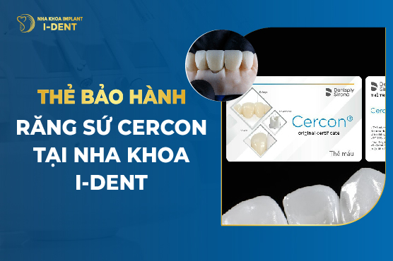 Thẻ Bảo Hành Răng Sứ Cercon Tại Nha Khoa I Dent
