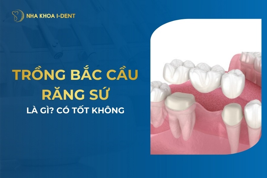 Trong Bac Cau Rang Su