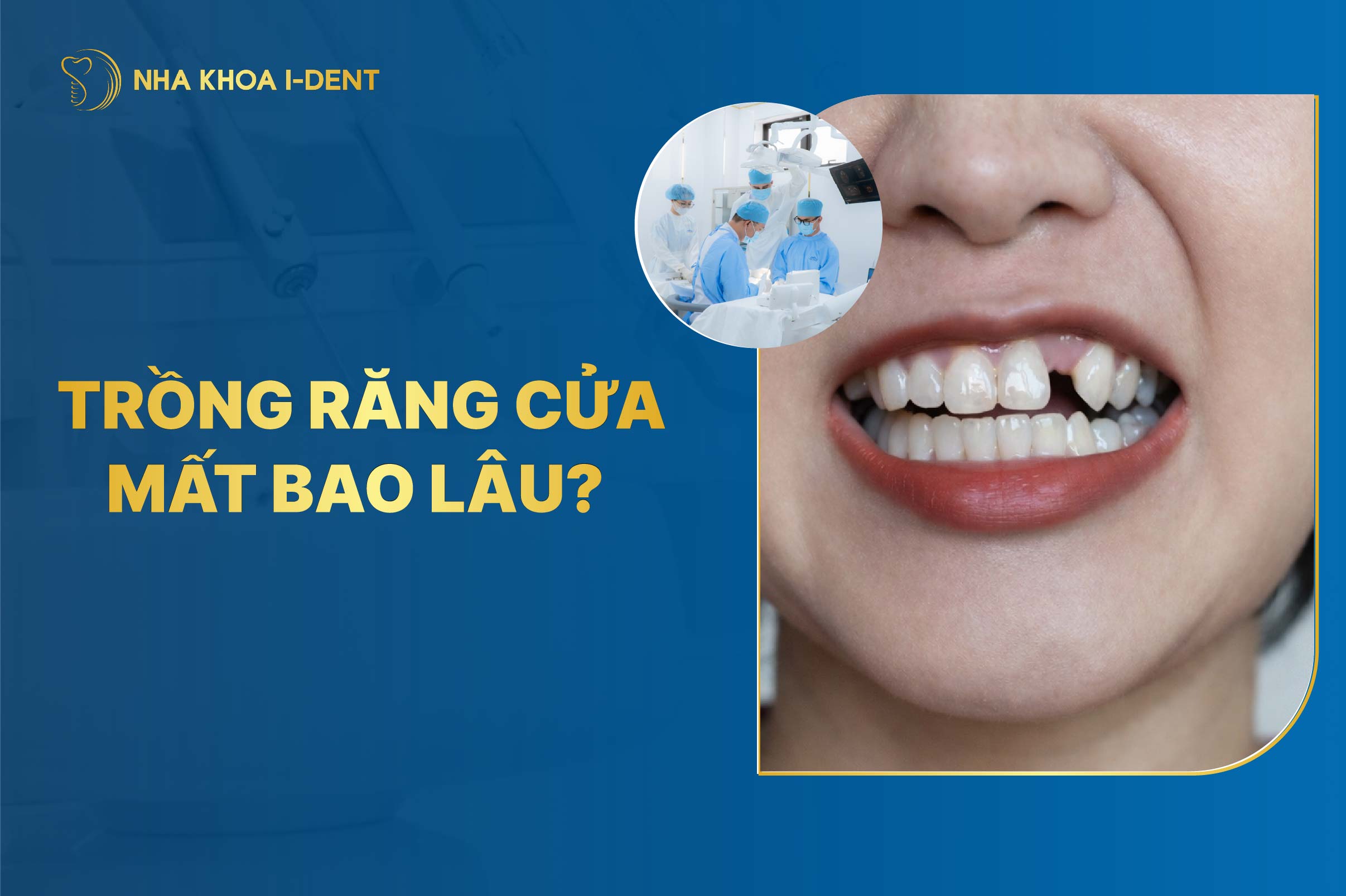 Trồng Răng Cửa Mất Bao Lâu