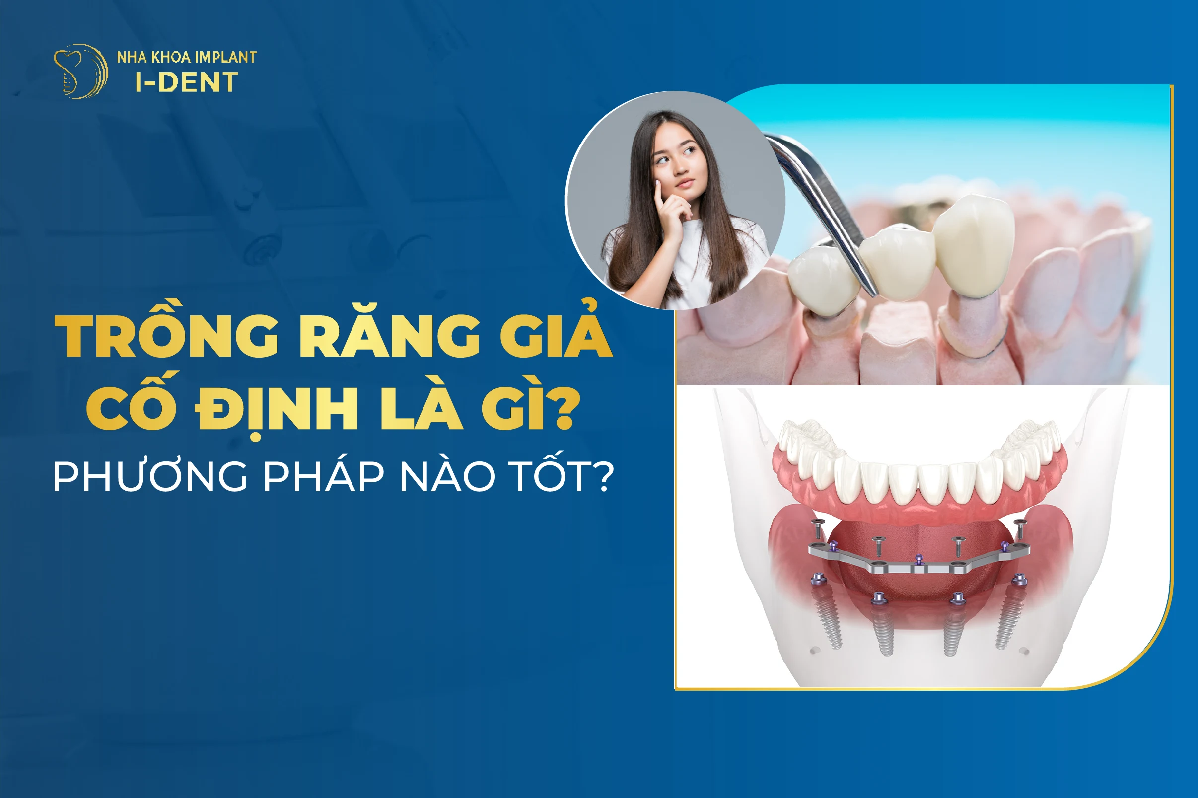 Trong Rang Gia Co Dinh La Gi Phuong Phap Nao Tot