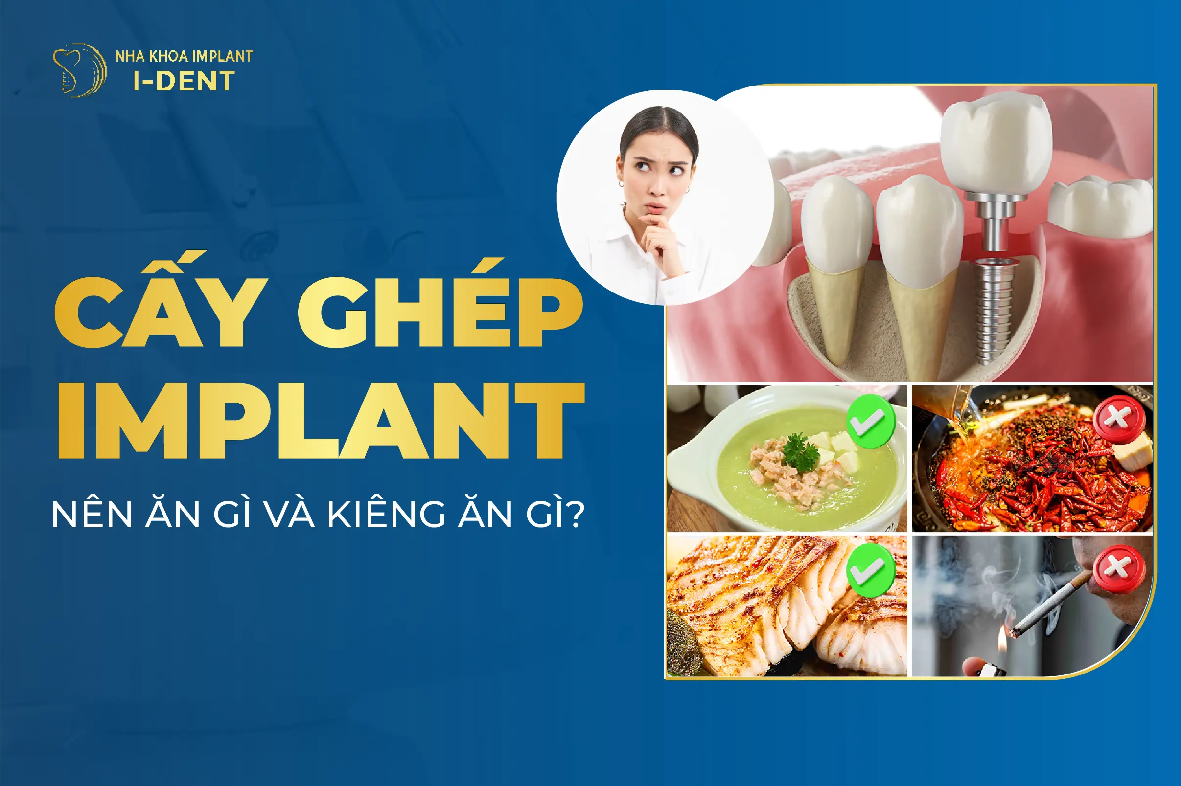 Trong Rang Implant Nen An Gi Kieng Gi