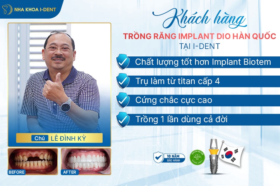trụ biotem