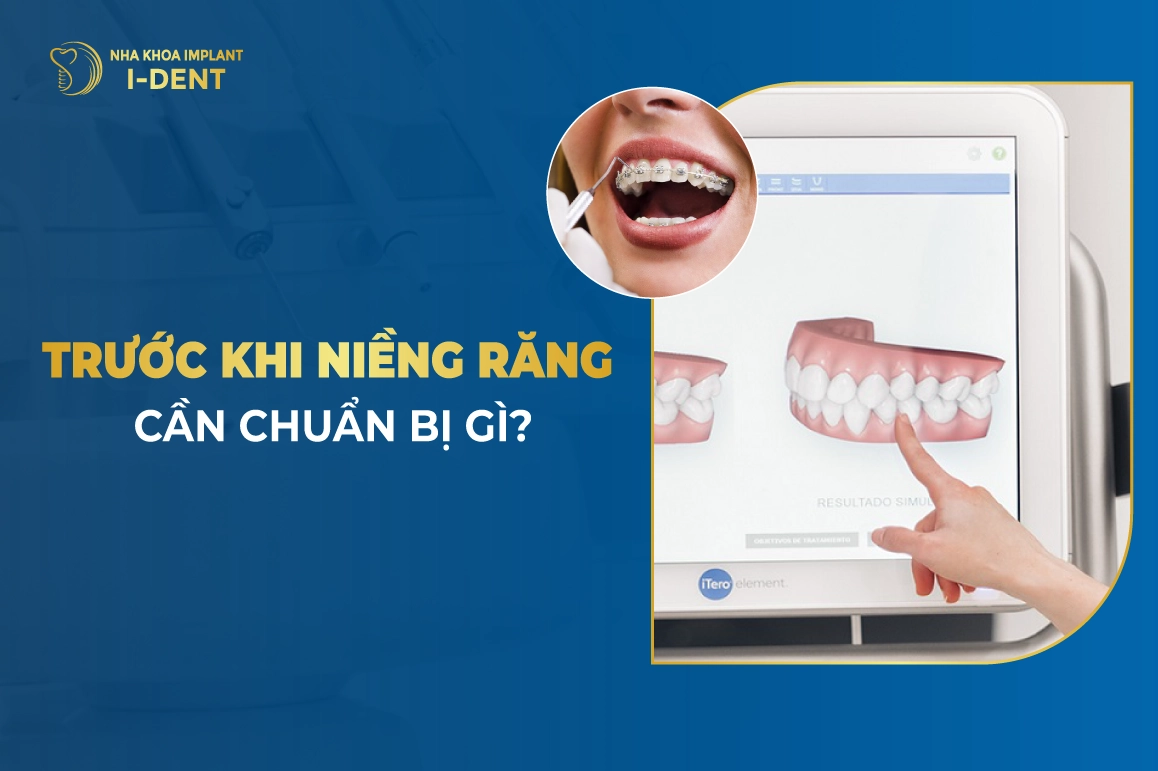Truoc Khi Nieng Rang Can Chuan Bi Gi