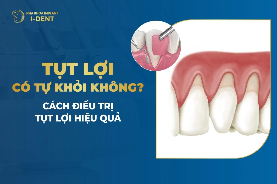 Tut Loi Co Tu Khoi Khong