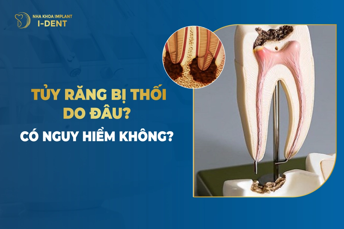 Tuy Rang Bi Thoi Do Dau