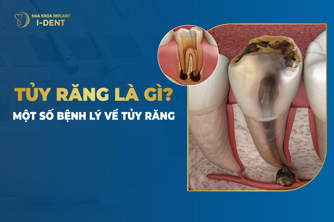 Tuy Rang La Gi Mot So Benh Ly Ve Tuy Rang