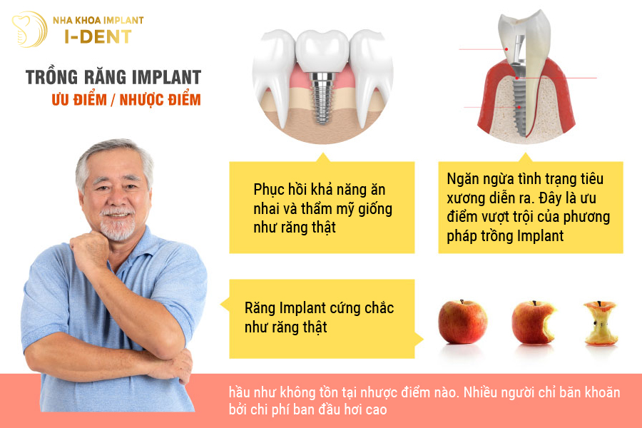 các phương pháp trồng răng