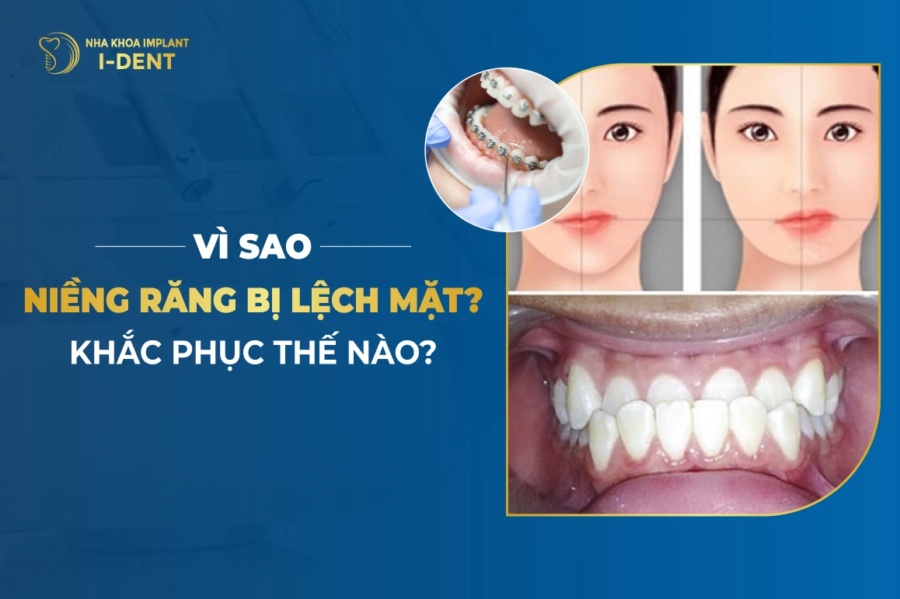 Vi Sao Nieng Rang Bi Lech Mat Khac Phuc The Nao E1763434975652