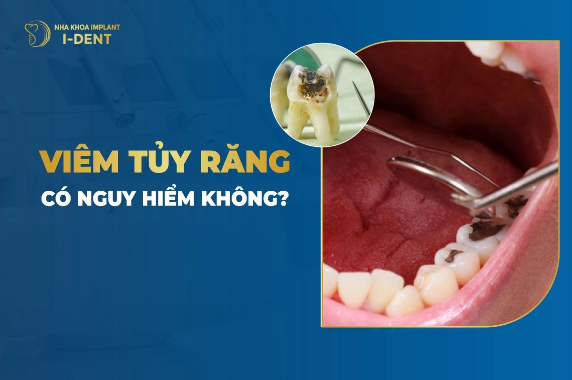 Viem Tuy Rang Co Nguy Hiem Khong