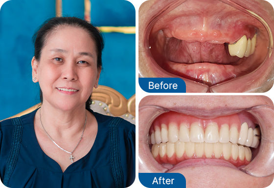 Ms. Thanh Huong